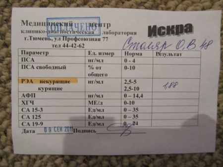 История успеха Оксаны Столяр (онкология) История успеха Оксаны Столяр (онкология)